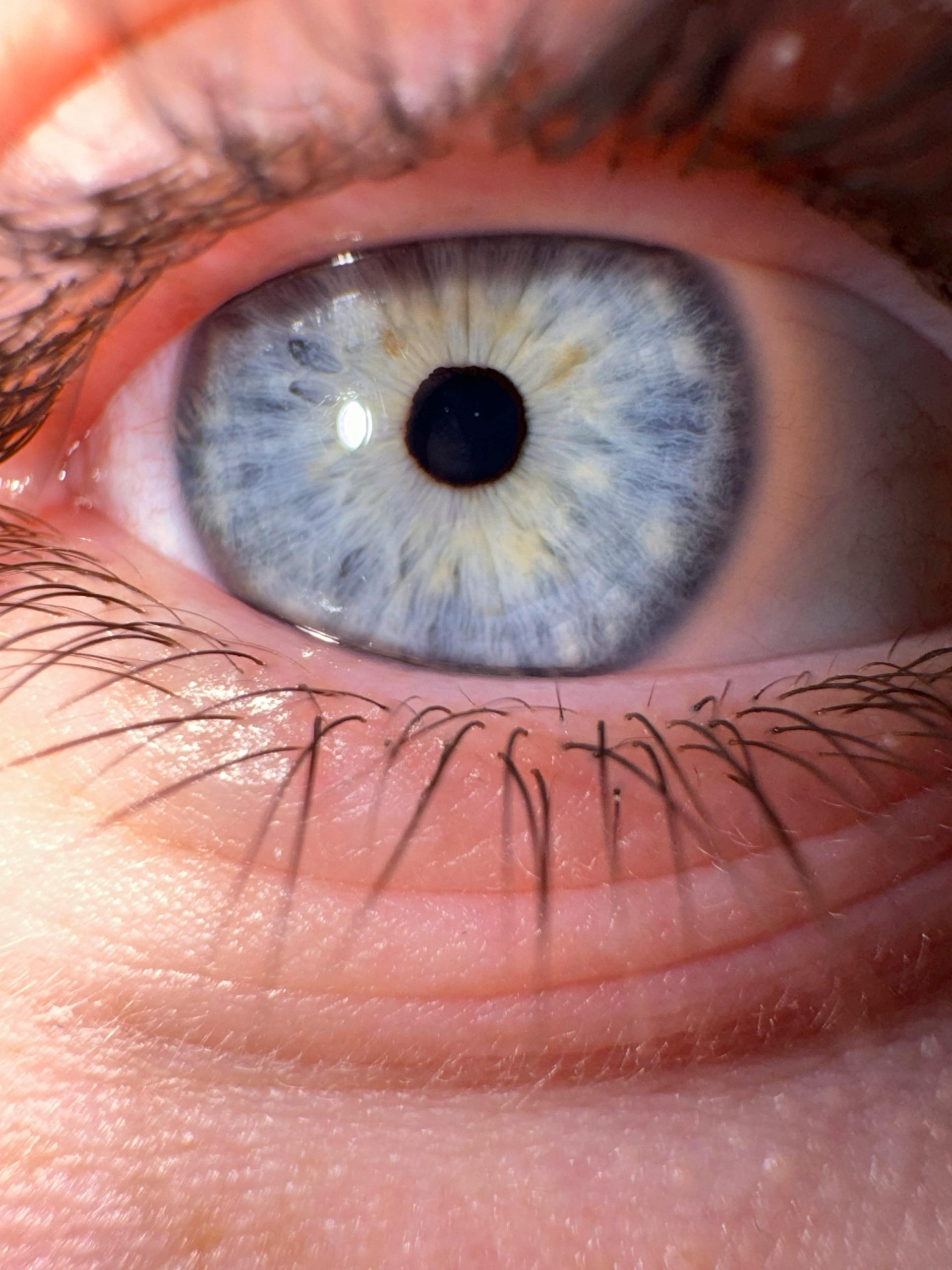 Experience Unmatched Precision With Lasik Istanbul Technology